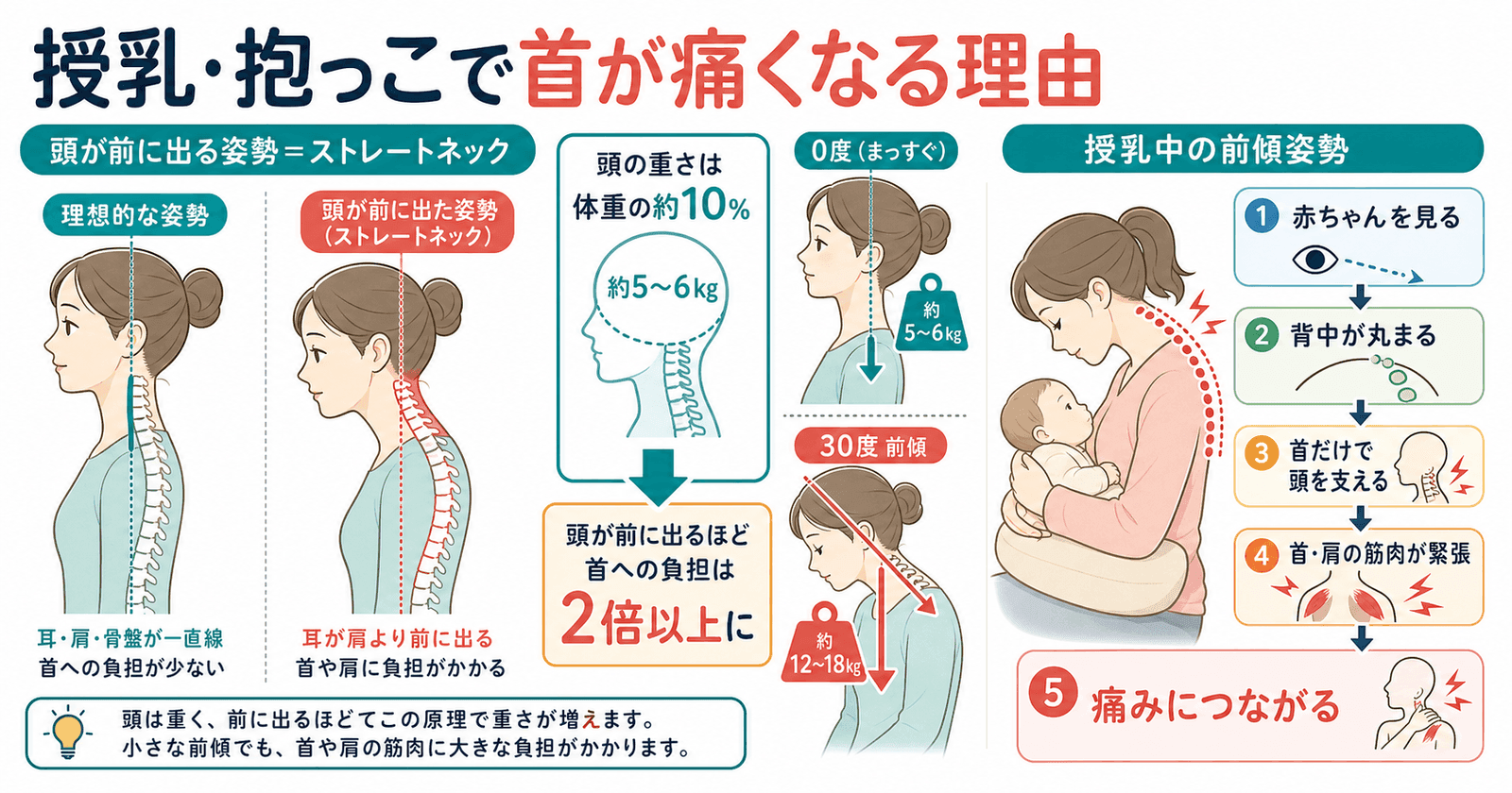 授乳・抱っこで首が痛くなる理由：頭の前傾と筋肉への負担