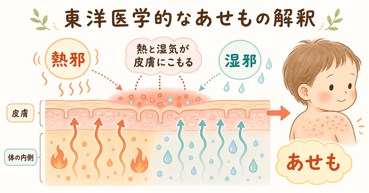 東洋医学的なあせもの解釈:熱邪と湿邪の問題